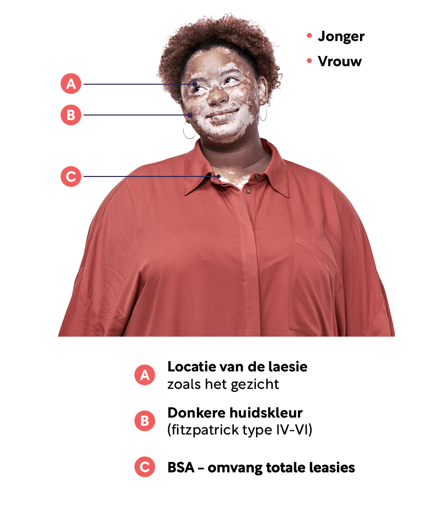 Woman with non-segmental vitiligo surrounded by information on non-segmental vitiligo global demographics.